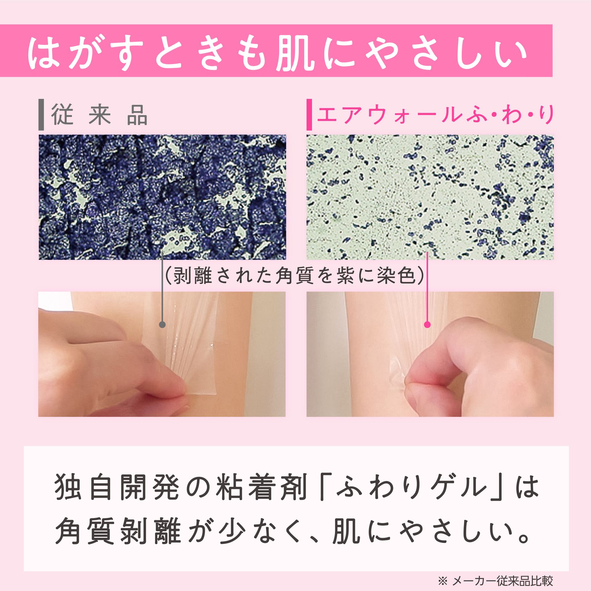 Skinix Air Wall Fuwari 5.9 inches x 16.4 ft (150 mm x 5 m) Ultra Zero Sensory Waterproof Film Roll Film Dressing, Transparent, 1 Roll MA-E5150FT