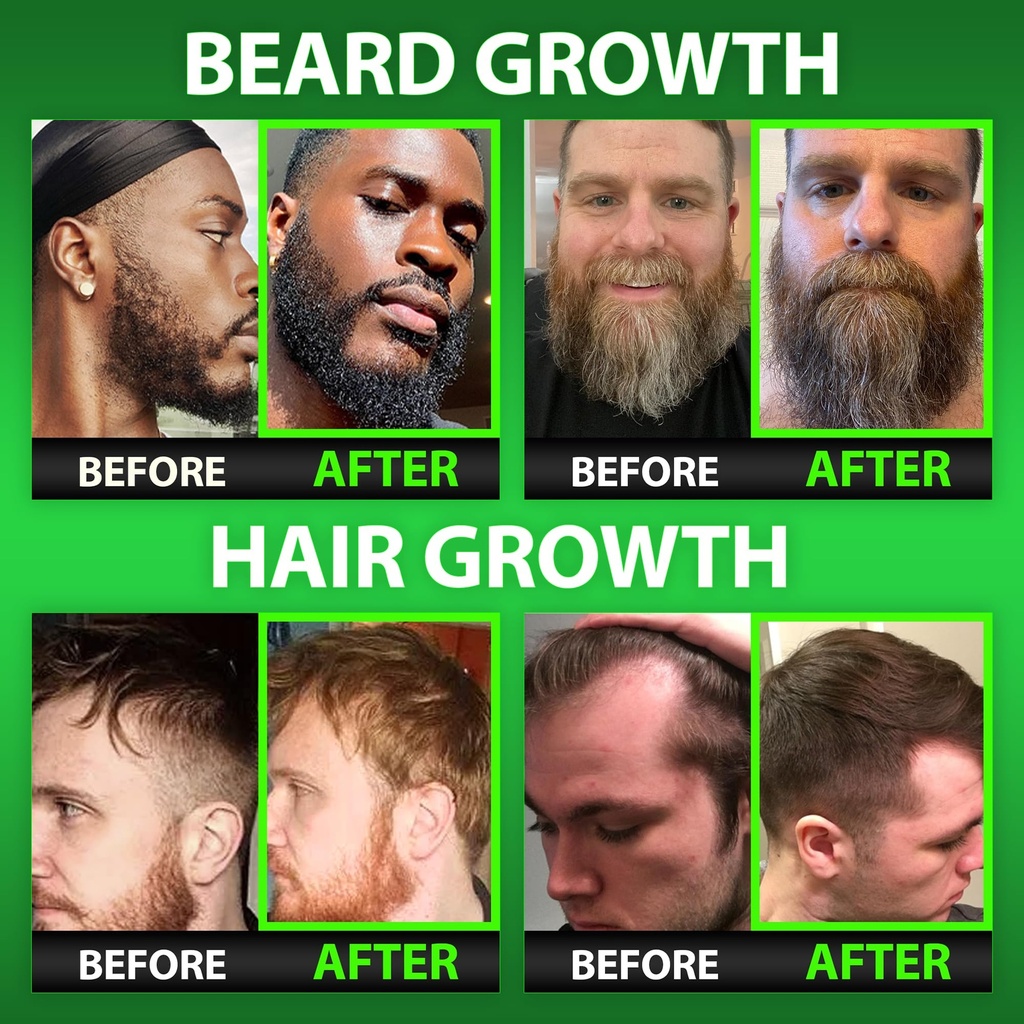 best-beard-stuff-beard-growth-vitamins-b-2.jpg