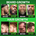 best-beard-stuff-beard-growth-vitamins-b-2.jpg