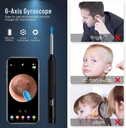 ear-wax-removal-tool-camera-wireless-ear-3.jpg