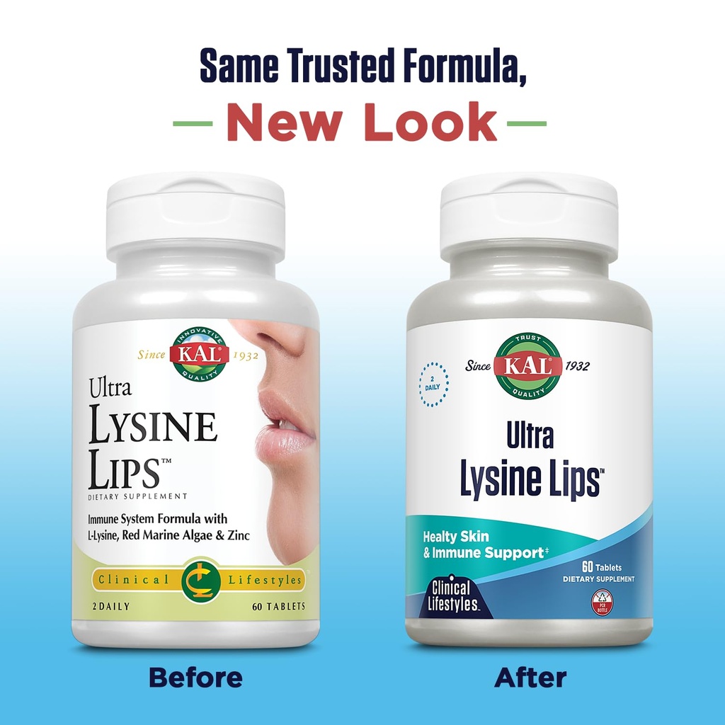 kal-ultra-lysine-lips-supplement-tablets-2.jpg