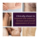 mederma-advanced-scar-gel-treats-old-and-5.jpg