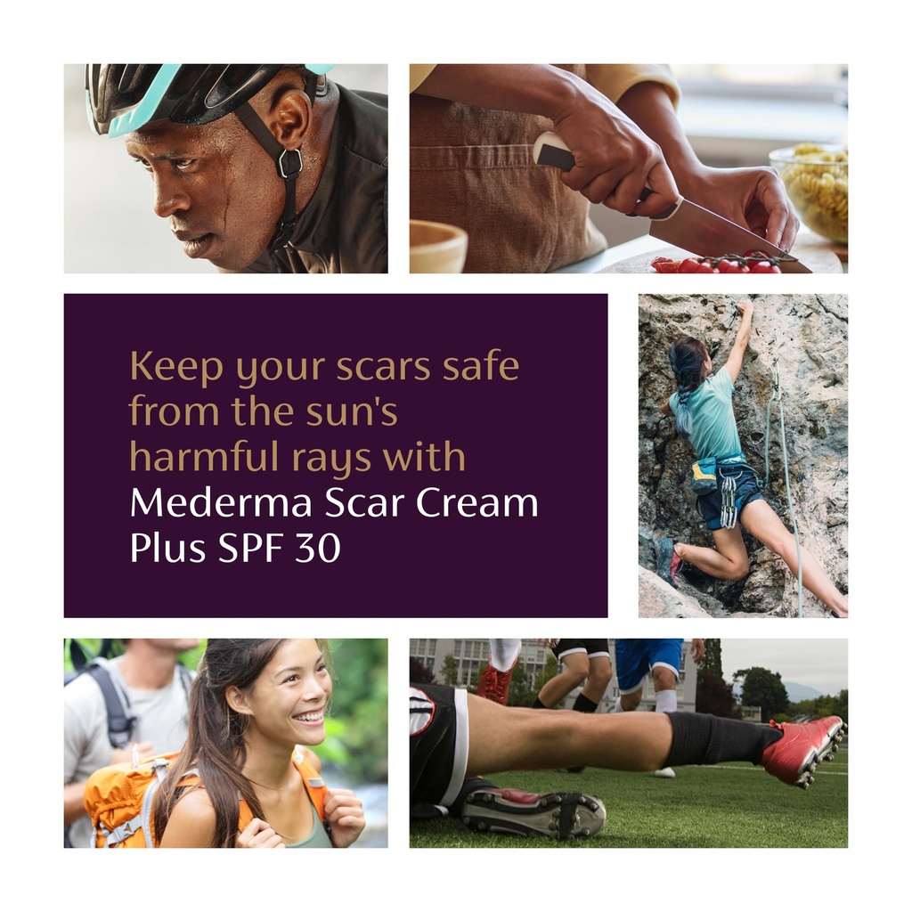 mederma-scar-cream-plus-spf-30-advanced--5.jpg