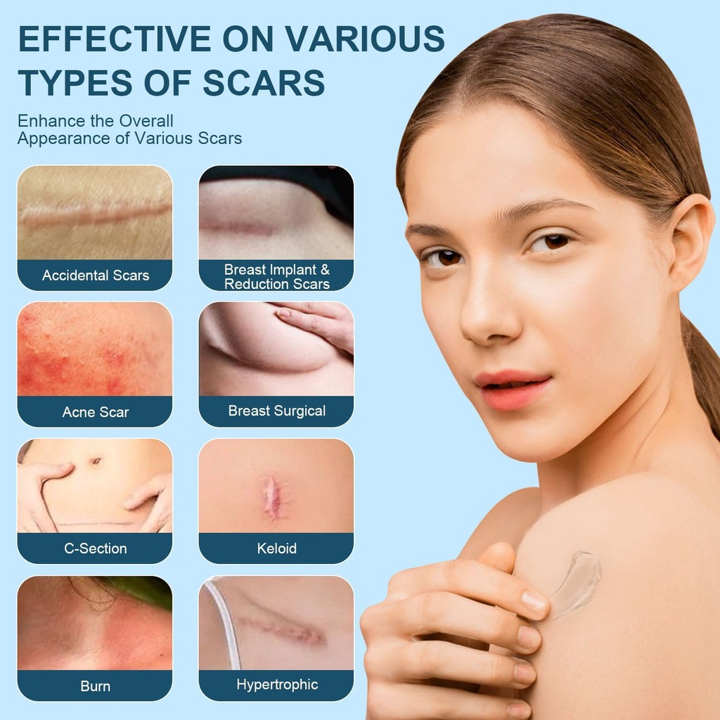mitgary-advanced-scar-gel-silicone-scar--4.jpg