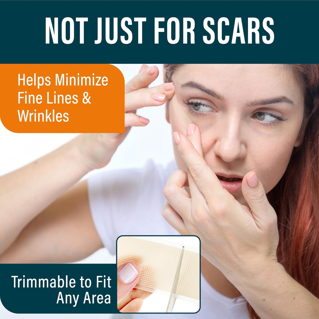 nuvadermis-silicone-scar-sheets-for-surg-3.jpg