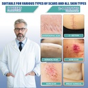 silicone-scar-sheets-silicone-scar-tape--2.jpg