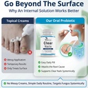 oral-probiotic-antifungal-pills-extra-st-3.jpg