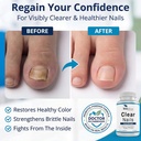 oral-probiotic-antifungal-pills-extra-st-2.jpg