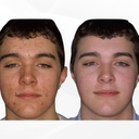 acnetame-acne-pills-30-day-supplements-f-5.jpg