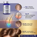 md-nutri-hair-growth-supplement-for-thin-5.jpg