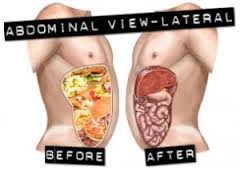 miracle-oxy-colon-cleanse-vegan-colon-cl-4.jpg