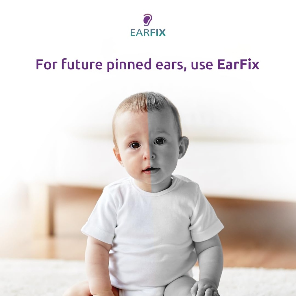 earfix-baby-ear-corrector-8-pack-gentle--5.jpg