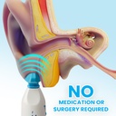 eardoc-ear-pressure-relief-device-ear-in-2.jpg