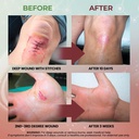 mediquick-skin-wound-care-hydrogel-drops-4.jpg