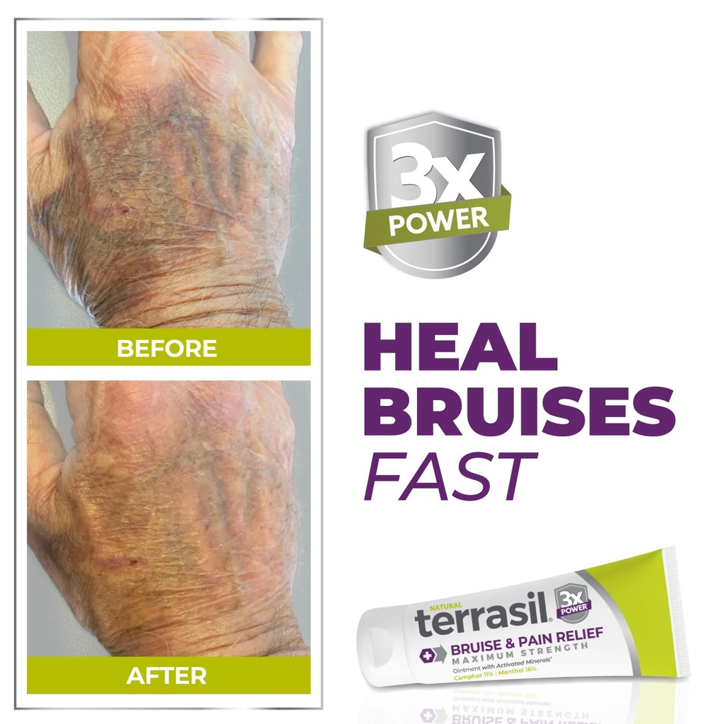 terrasil-arnica-bruise-cream-for-thin-sk-2.jpg