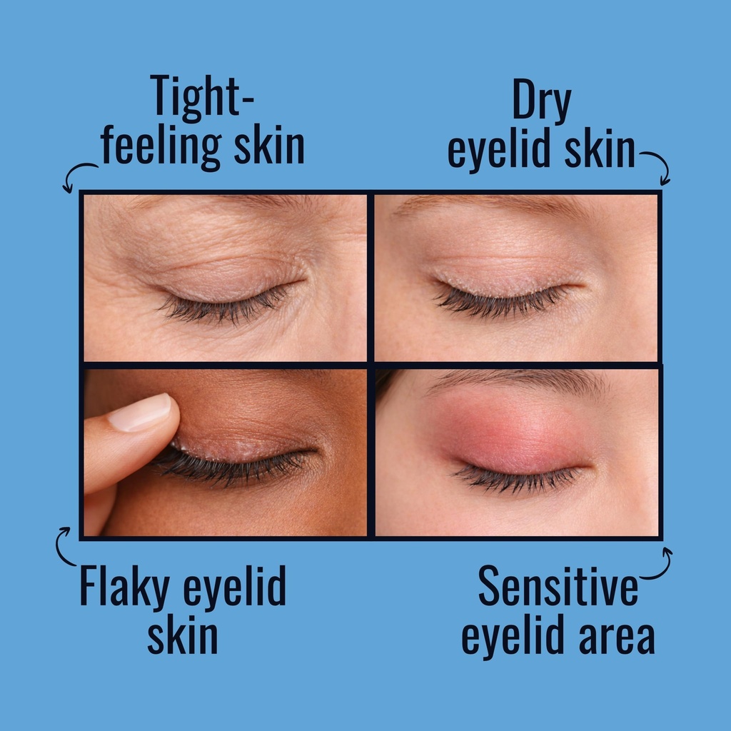 noveha-nighttime-eyelid-ointment-night-g-4.jpg