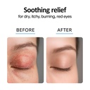 eyelid-cleanser-spray-8oz-blepharitis-tr-3.jpg