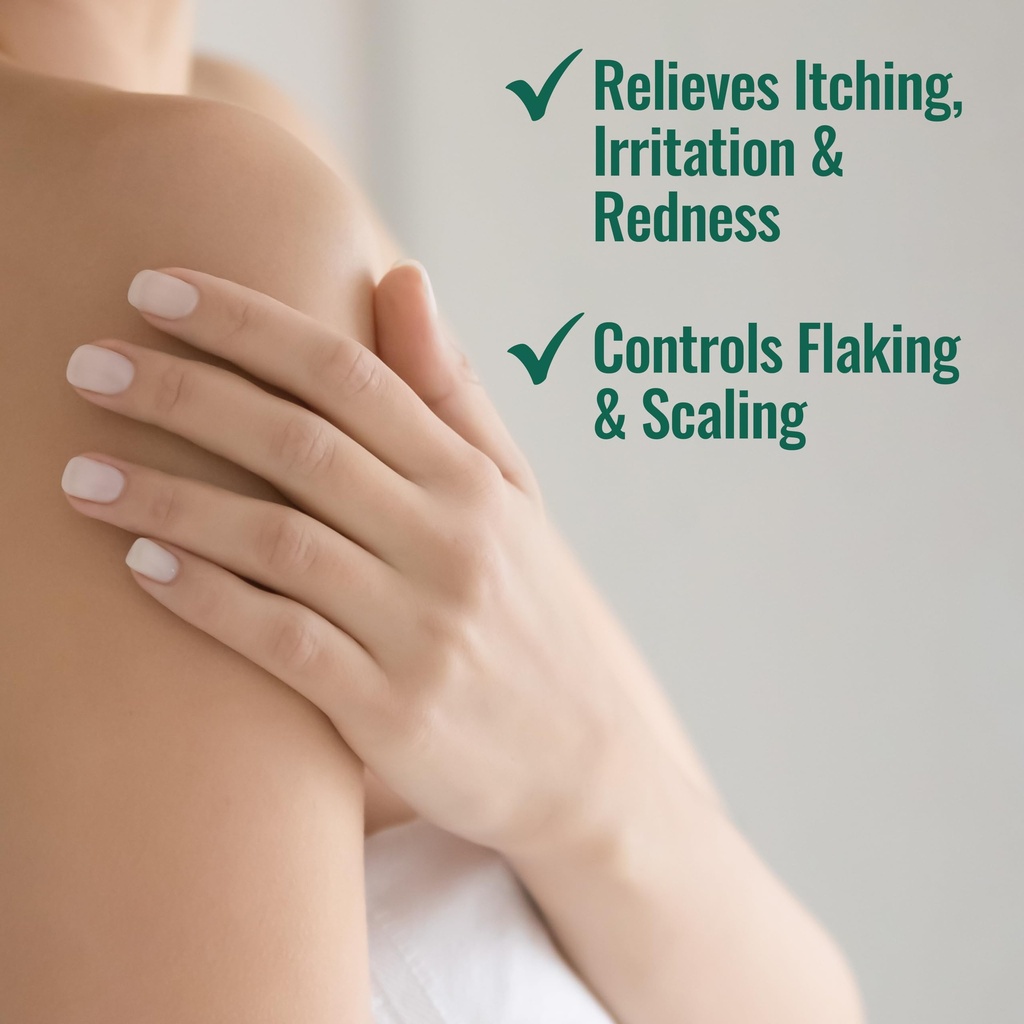 nizoral-psoriasis-relief-cream-maximum-s-4.jpg