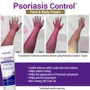 triderma-psoriasis-control-face-body-cre-3.jpg