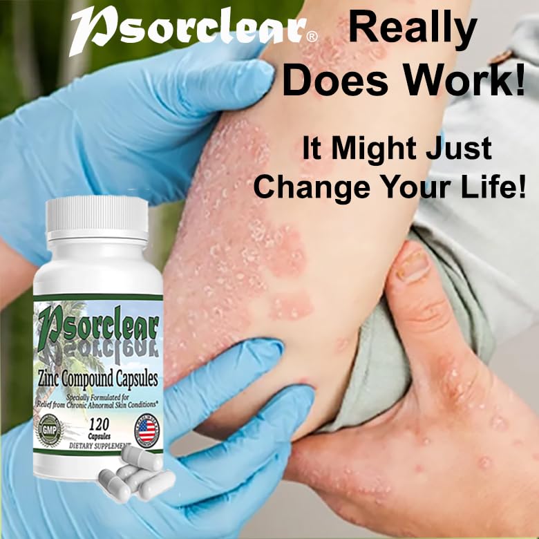 psorclear-psoriasis-eczema-relief-a-prov-6.jpg