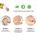 5pcs-chinese-herbal-eczema-psoriasis-cre-6.jpg