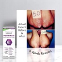 loma-lux-psoriasis-relief-natural-w-mine-5.jpg