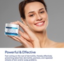 roycederm-seborrheic-dermatitis-cream-sc-4.jpg