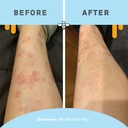 psoriasis-honey-daily-moisturizing-body--5.jpg