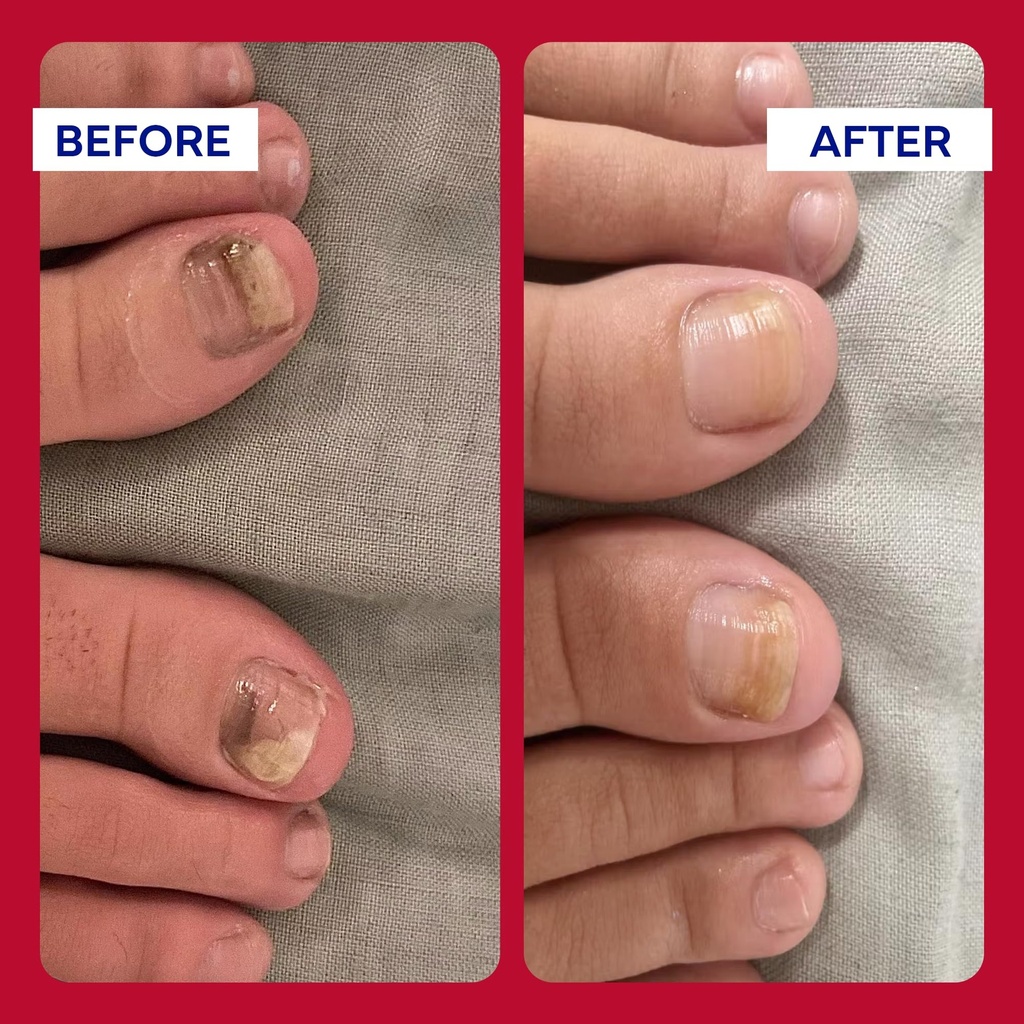 emuaidmax-homeopathic-psoriasis-scalp-tr-4.jpg
