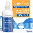 skinsmart-antimicrobial-eczema-therapy-w-4.jpg