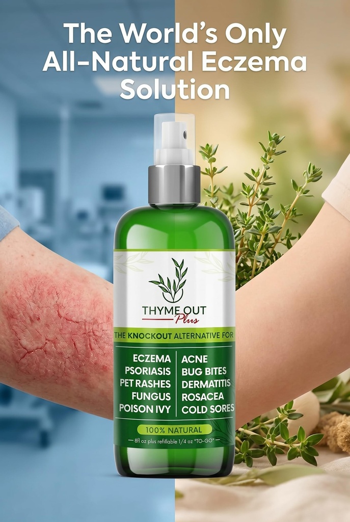 thyme-out-plus-natural-skin-relief-spray-2.jpg