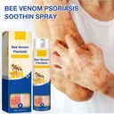 cuoct-2-pcs-psoriaheal-bee-venom-psorias-4.jpg