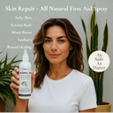 loma-lux-new-eczemol-otc-spray-natural-n-2.jpg