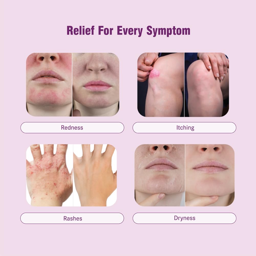 think-smarter-products-eczema-psoriasis--4.jpg