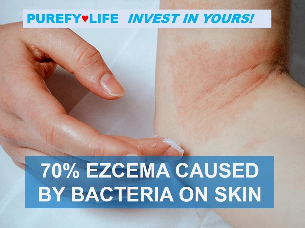 purefy-dermal-eczema-airesol-spray-3-4oz-3.jpg