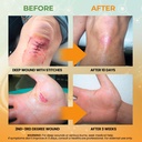 mediquick-skin-wound-repair-first-aid-sp-5.jpg