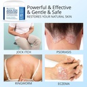 hermon-jock-itch-antifungal-cream-spray--2.jpg