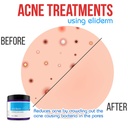 topical-probiotic-skin-cream-4oz-jar-13--4.jpg