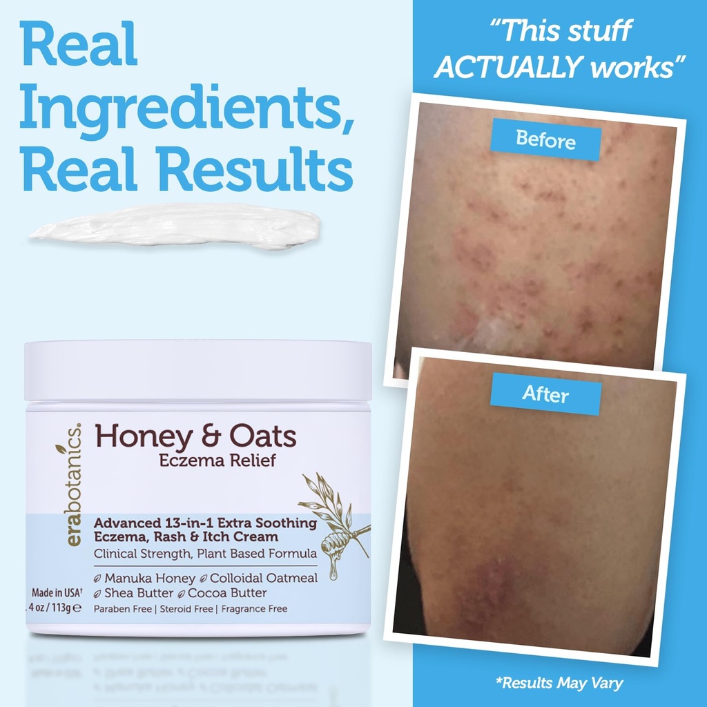 eczema-cream-with-manuka-honey-colloidal-5.jpg