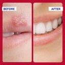 emuaid-emuaidmax-ointment-for-itchy-skin-6.jpg