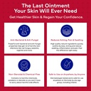 emuaid-emuaidmax-ointment-for-itchy-skin-4.jpg