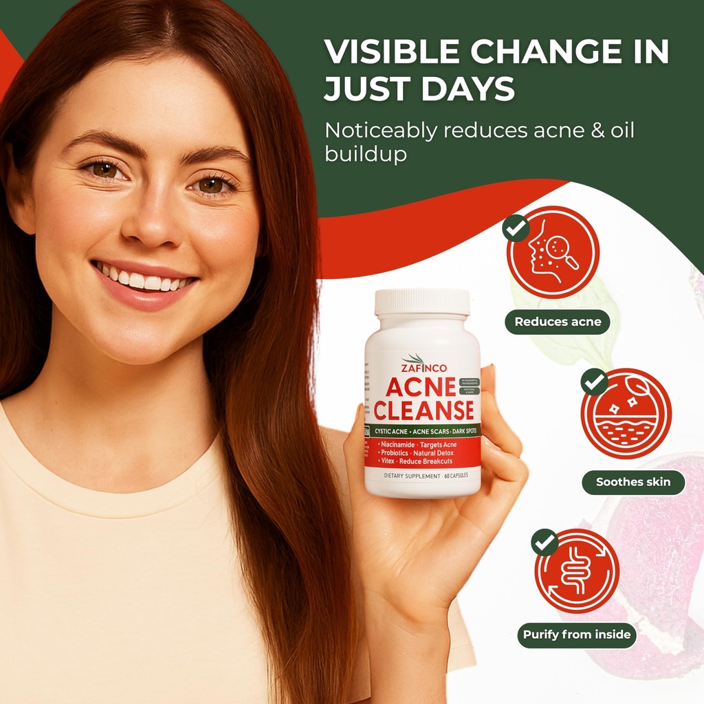 zafinco-acne-cure-cream-for-women-and-me-6.jpg