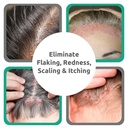dr-blaine-s-scalp-psoriasis-serum-for-it-3.jpg