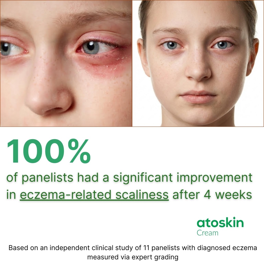 atoskin-eczema-cream-psoriasis-folliculi-6.jpg