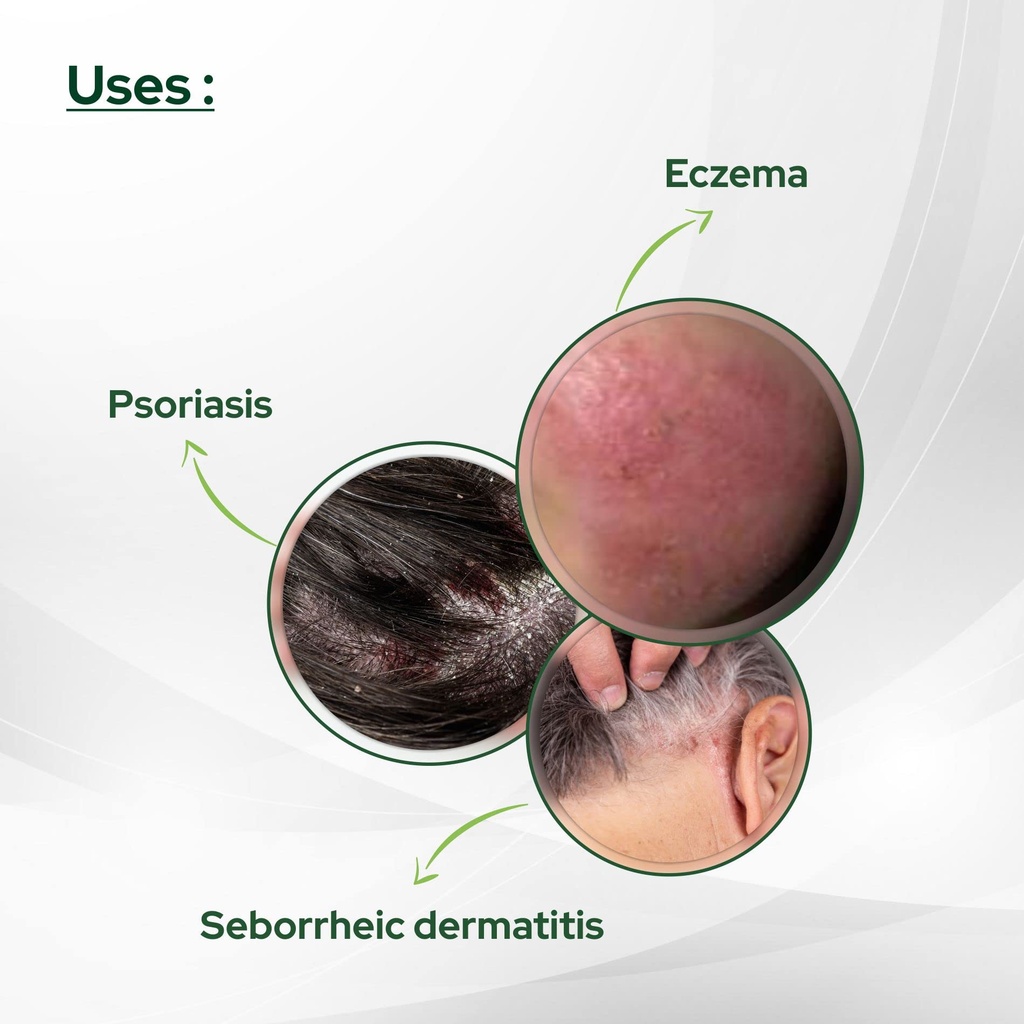 salve-cosalic-coal-tar-salicylic-acid-oi-4.jpg