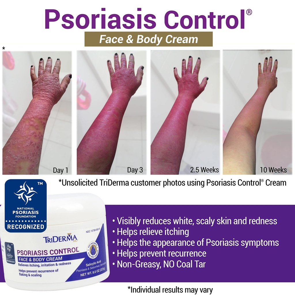 triderma-psoriasis-control-face-body-cre-2.jpg