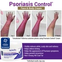 triderma-psoriasis-control-face-body-cre-2.jpg