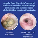 angels-eyes-zinc-otic-ear-relief-treatme-3.jpg
