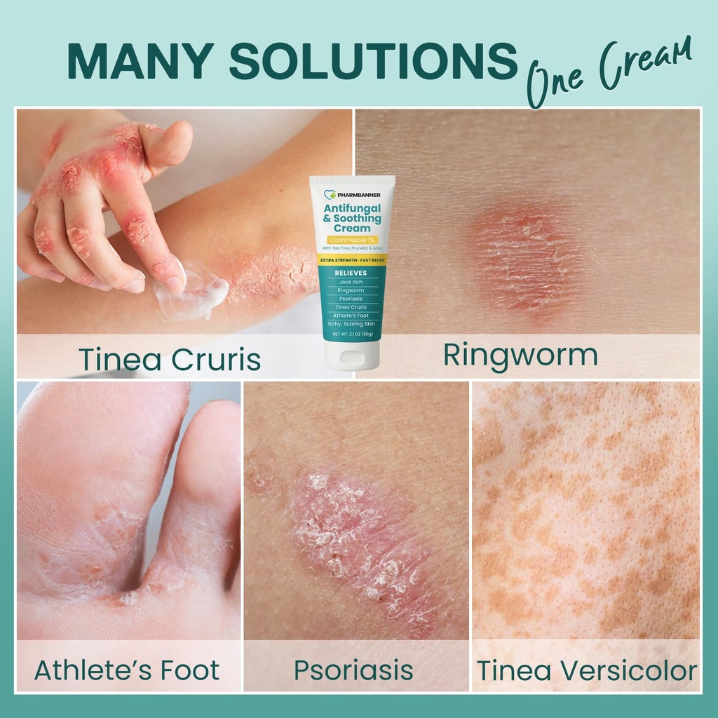 antifungal-cream-for-jock-itch-ringworm--3.jpg