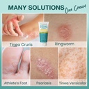 antifungal-cream-for-jock-itch-ringworm--3.jpg
